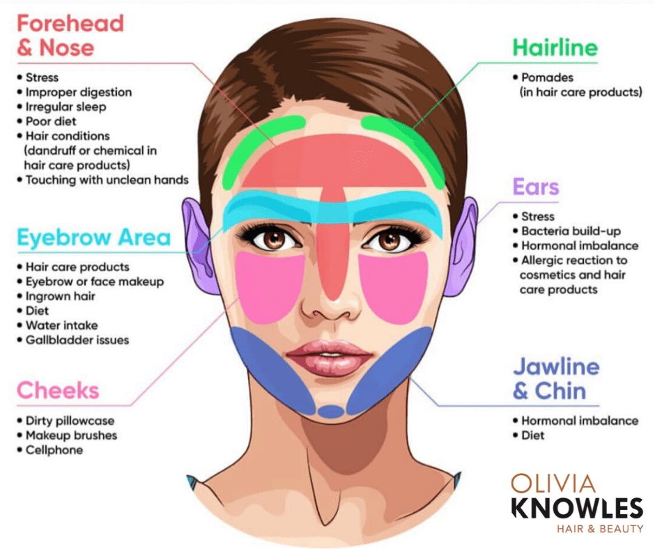 Acne & Breakouts